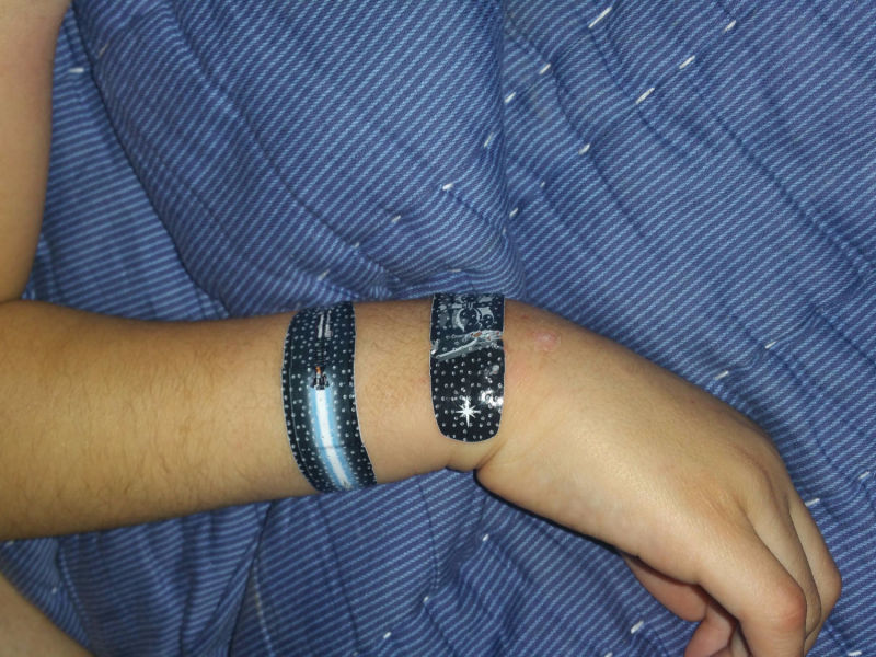 image of an arm with band aids