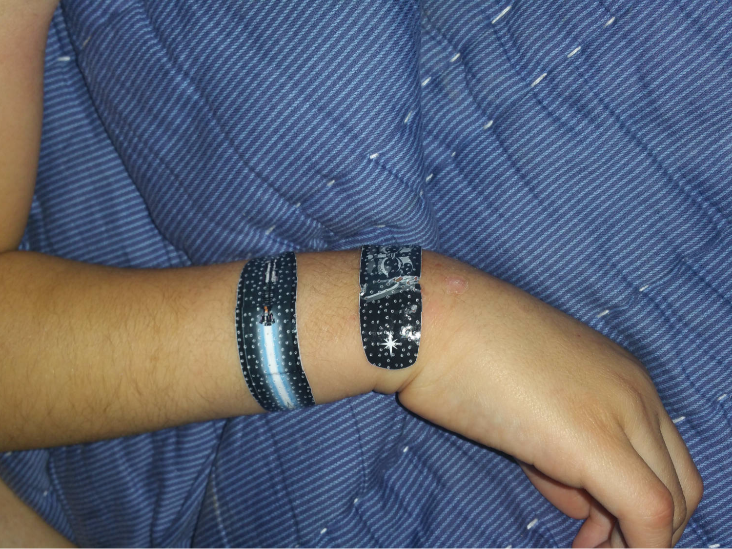 image of an arm with band aids